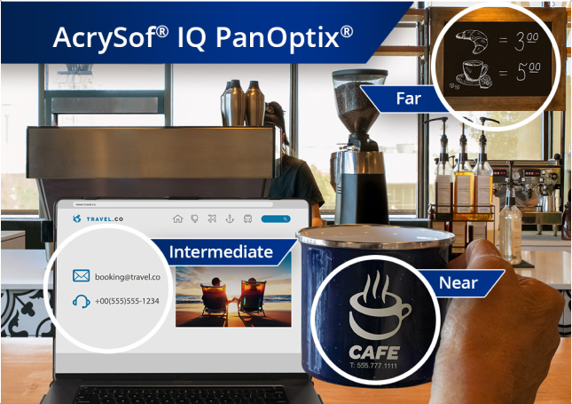 Coffee shop with a view from the counter of coffee machines and other ingredients. A laptop is open on the countertop and an individual’s hand holds up a coffee mug to the right of the laptop screen. The image has 3 circles that zoom in on different aspects of the image. One of the circles is on the laptop screen to showcase an intermediate view with the AcrySof IQ PanOptix lens. Another circle is on the coffee mug to showcase a near view with the AcrySof IQ PanOptix lens. The last circle is on the café menu board, to showcase a far view with the AcrySof IQ PanOptix lens