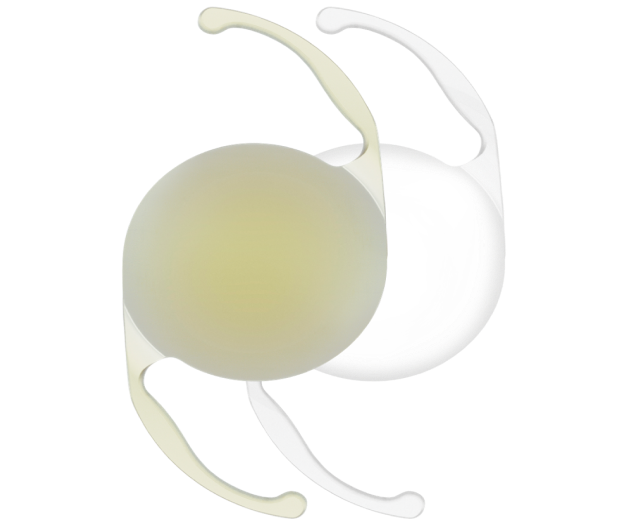 3-dimensional image of a yellow AcrySof IQ Monofocal IOLs and a clear AcrySof IQ Monofocal IOLs side-by-side.
