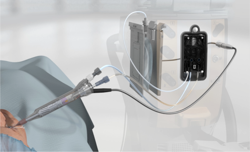 An illustration of CENTURION® Vision System with plus-sign buttons highlighting the irrigation pressure sensor, the ACTIVE SENTRY® Handpiece, Active Fluidics™ Technology and QuickValve™ Technology.
