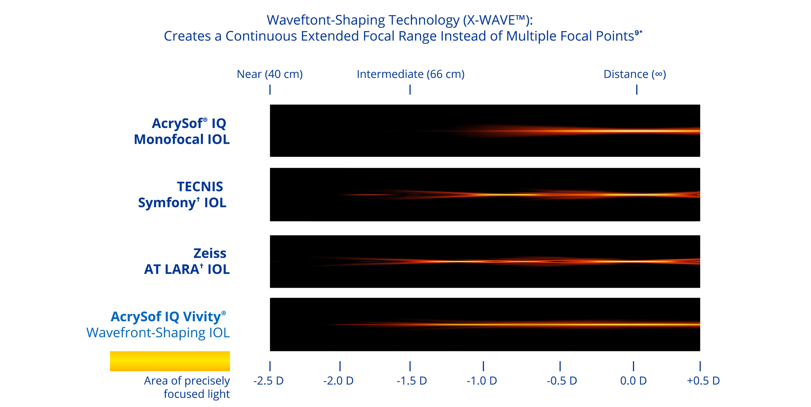 A graphic illustrating the range of vision with four different IOLs. The AcrySof® IQ monofocal IOL provides distance vision. The Symfony IOL provides distance, intermediate and near vision. The AT LARA IOL provides vision at distance and two intermediate focal points. The AcrySof IQ Vivity® IOL provides a continuous range of vision from distance to functional near.