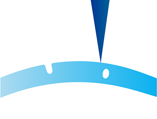 Corneal Incisions Image