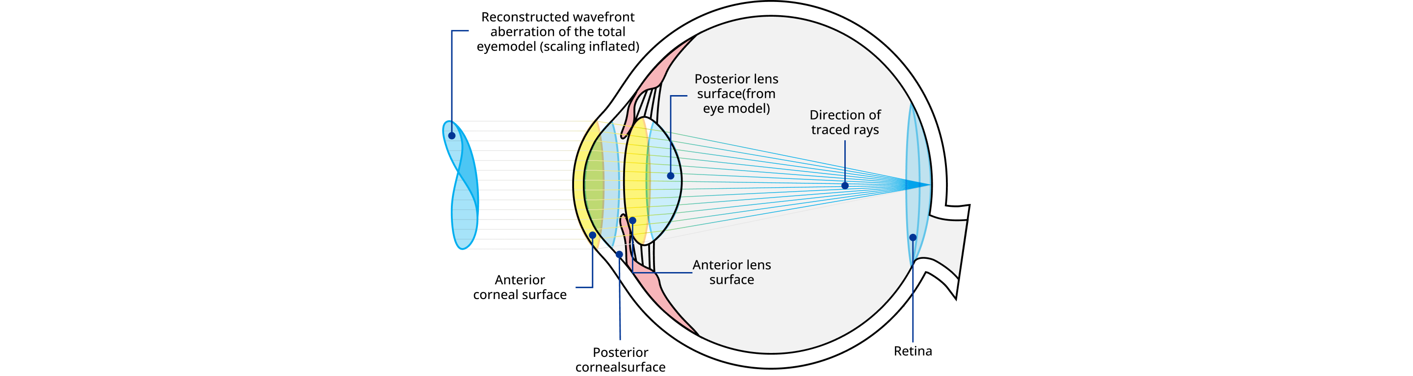 Cross-section image of the eye with descriptions