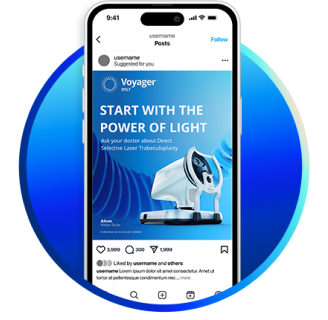 Smartphone screen displaying a social media post for Voyager DSLT with the message 'Start with the Power of Light' and an image of the glaucoma laser device