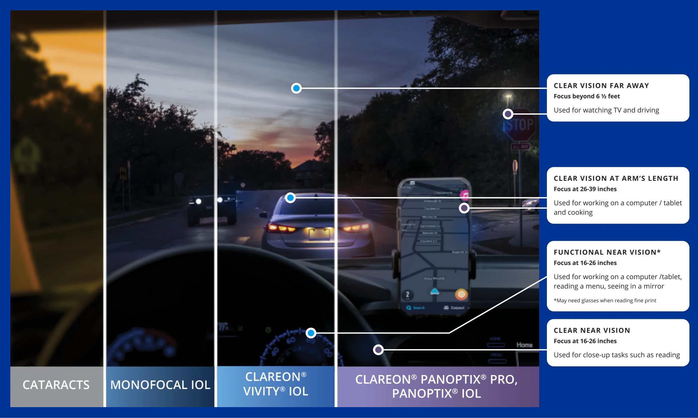 Nighttime comparison of cataracts, monofocal, Vivity, and PanOptix lenses showing clarity at distance, intermediate, and near vision.