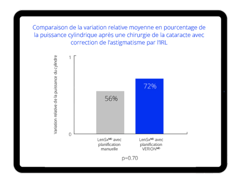 LenSxMD avec planification VERIONMD a une variation relative de 72 % de la puissance du cylindre, 16 % supérieur à LenSxMD avec planification manuelle