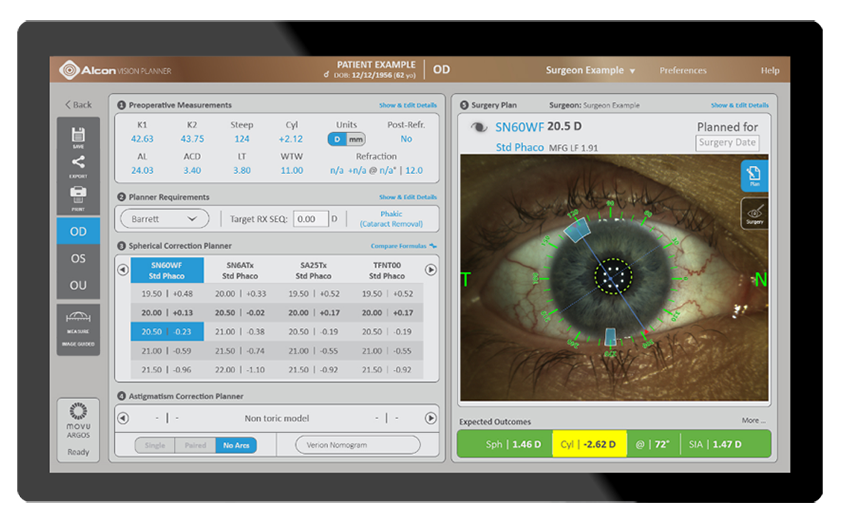 Capture d’écran d’ordinateur du biomètre ARGOSMD et de la technologie Vision Planner d’Alcon générant les mesures oculaires du patient.