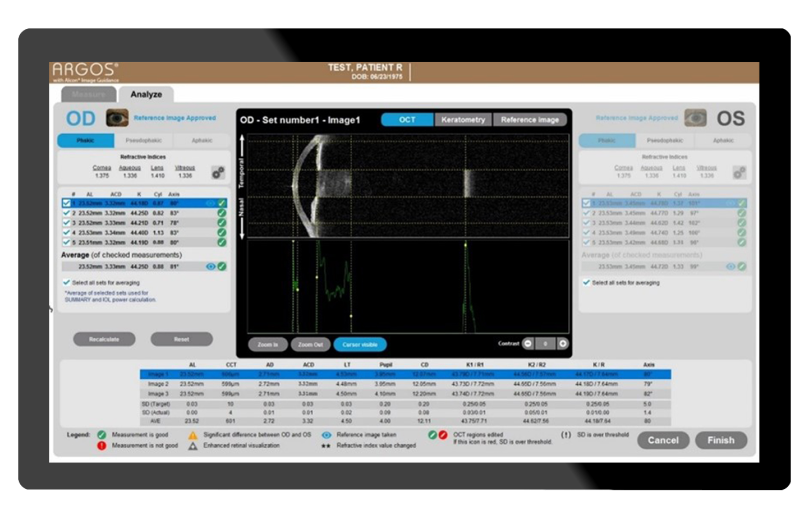 Capture d’écran d’ordinateur du biomètre ARGOSMD avec guidage par imagerie d’Alcon générant les mesures oculaires du patient.