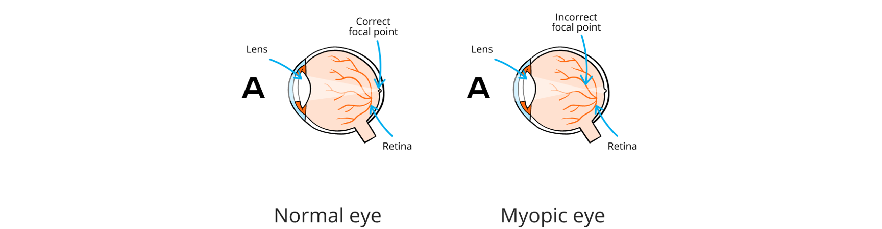Infographic of eye