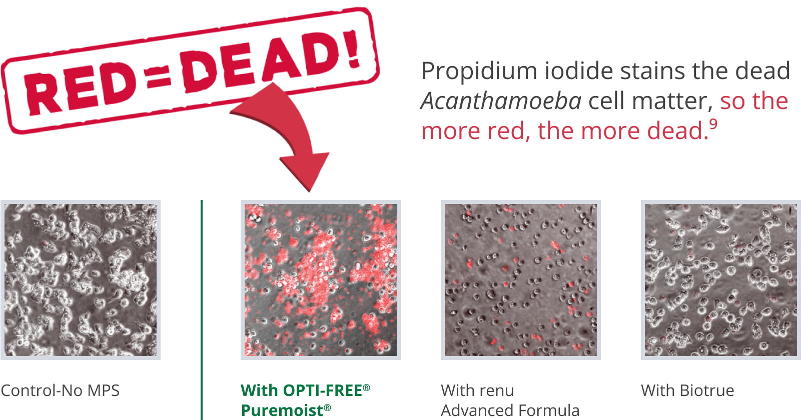 Graphic with text and image of Acanthamoeba cells