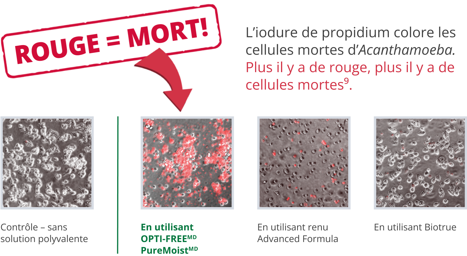 Graphic with text and image of Acanthamoeba cells