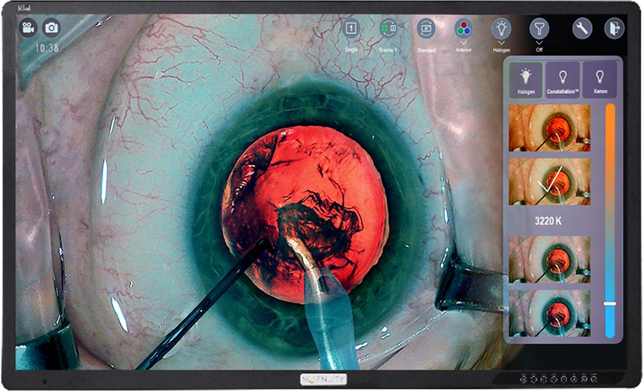 Close-up of the eye surgery