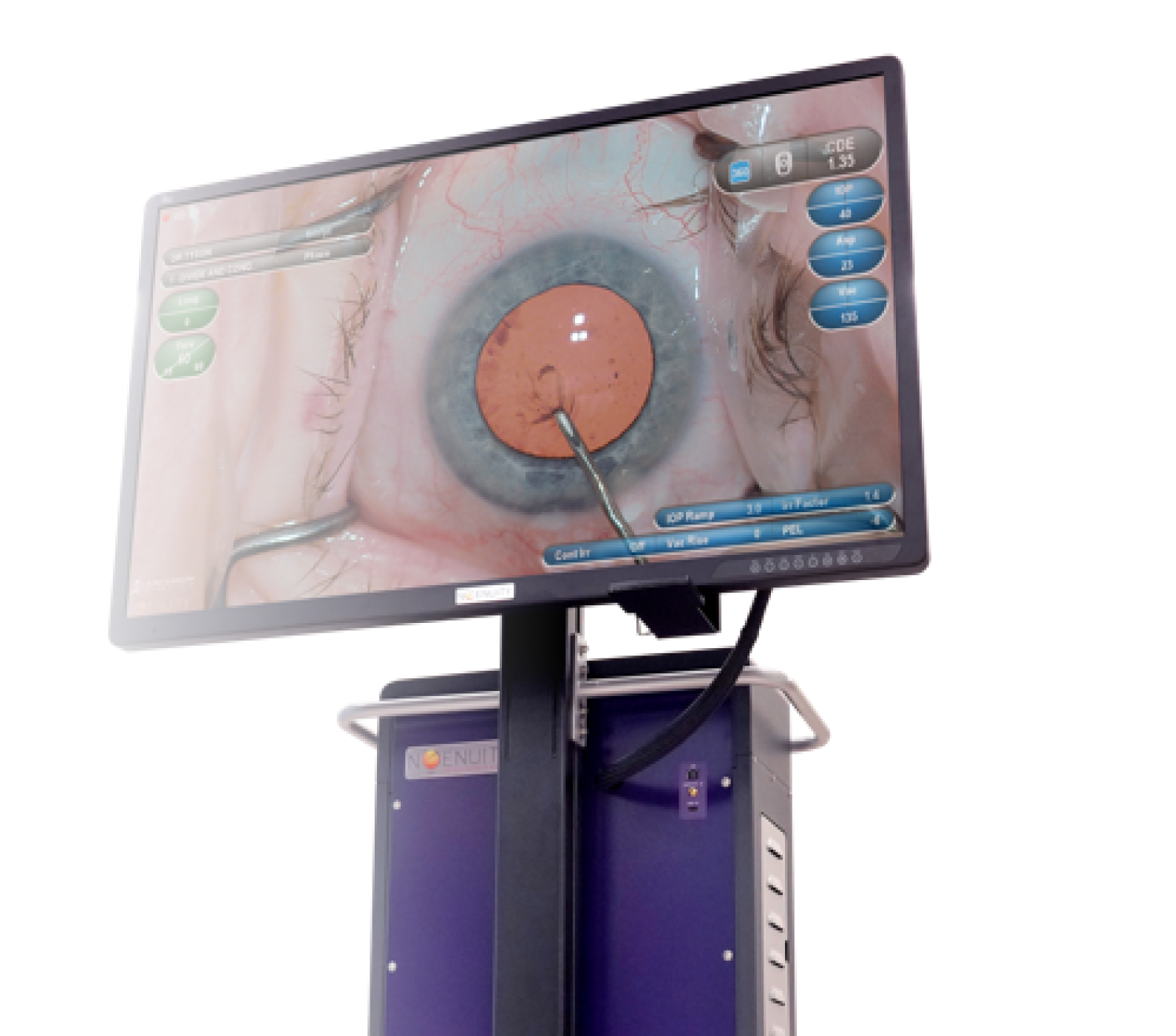 NGENUITY Image