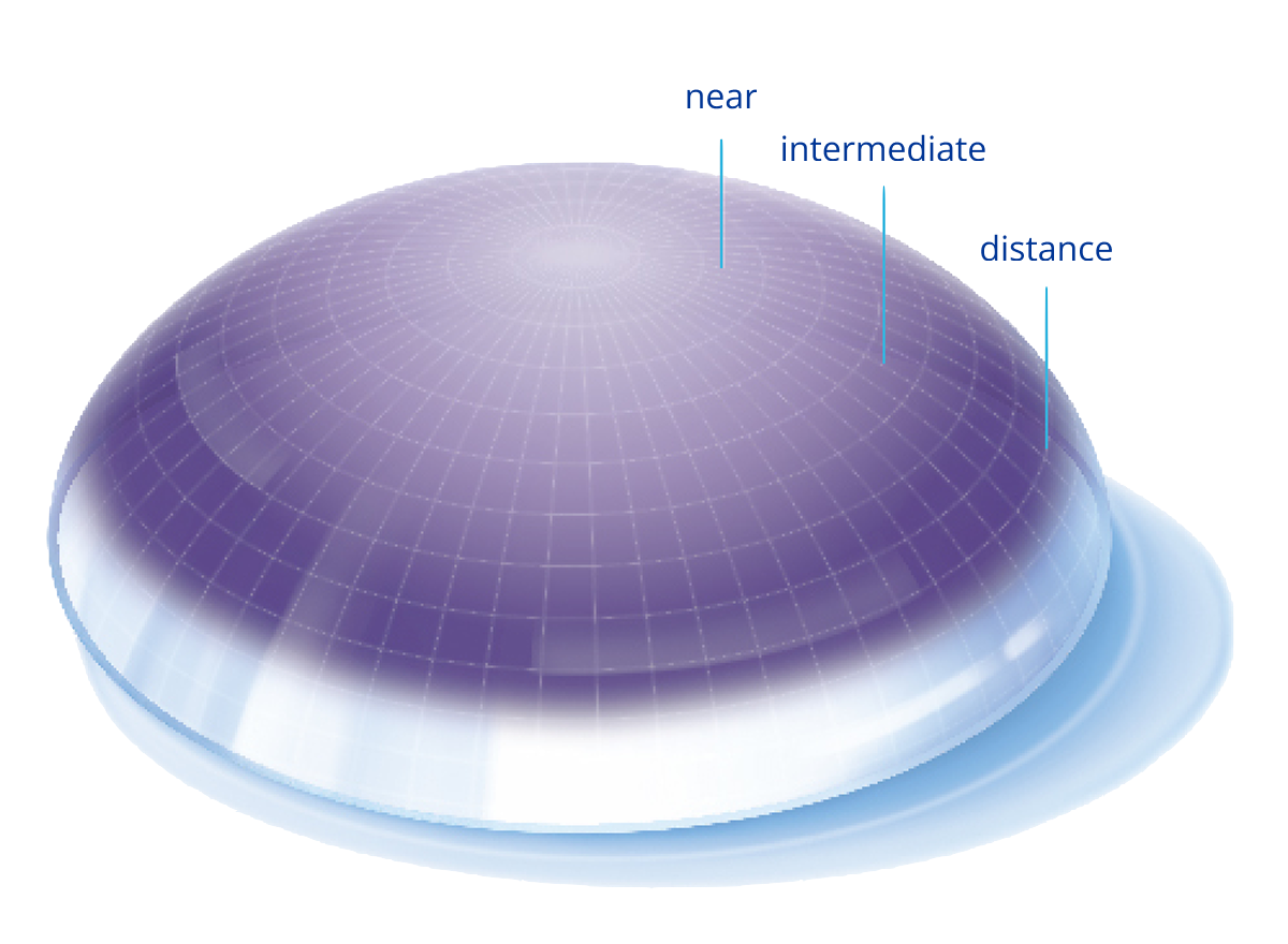 Precision profile image