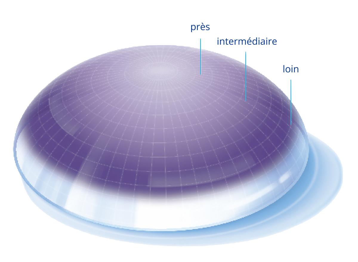 Precision profile image