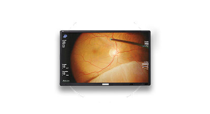 Close up of the NGENUITY screen in front on a white circle.