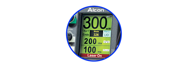 Close up of the PUREPOINT Laser System’s settings screen.