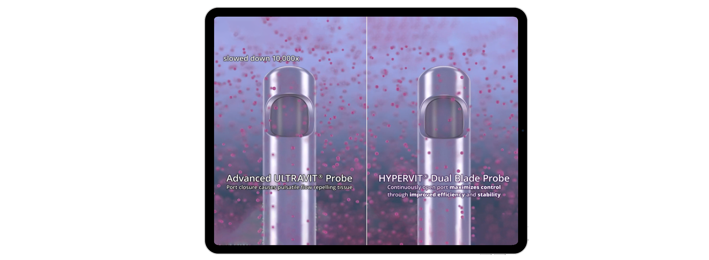 A computer-generated image showing the Advanced ULTRAVIT Probe tip on the left with text that reads, “Port closure causes pulsatile flow repelling tissue”, and the HYPERVIT Dual Blade Probe on the right with text that reads, “Continuously open port maximises control through improved efficiency and stability”. The probes are surrounded by vitreous humour to illustrate vitreous flow.