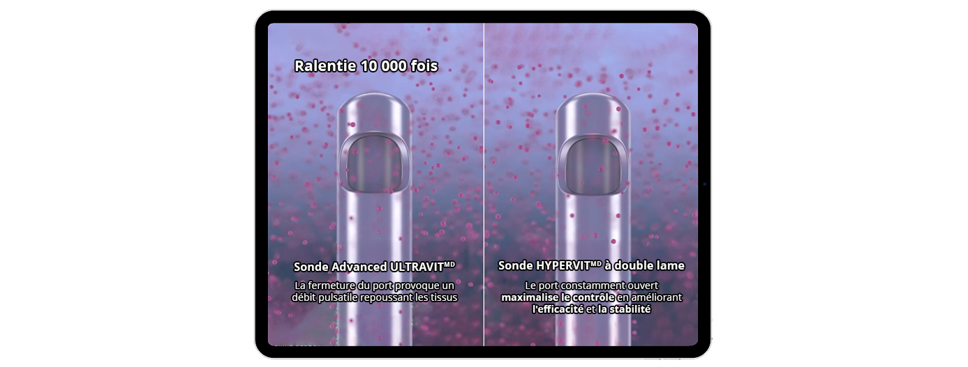 A computer-generated image showing the Advanced ULTRAVIT Probe tip on the left with text that reads, “Port closure causes pulsatile flow repelling tissue”, and the HYPERVIT Dual Blade Probe on the right with text that reads, “Continuously open port maximises control through improved efficiency and stability”. The probes are surrounded by vitreous humour to illustrate vitreous flow.