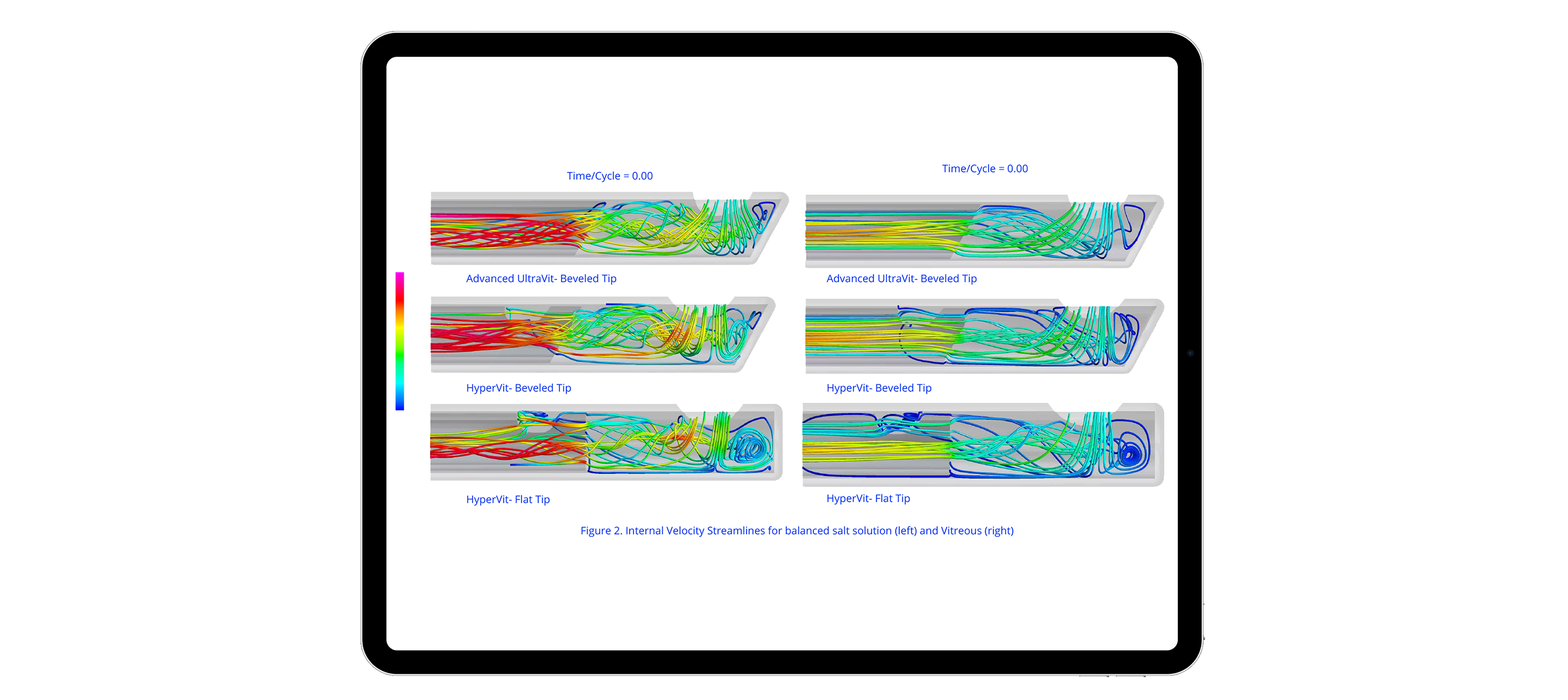 An image comparing the back flow with Advanced ULTRAVIT, HYPERVIT Beveled Tip and HYPERVIT Flat Tip probes in balanced salt solution and vitreous. The HYPERVIT Beveled Tip has reduced back flow compared to the other probes.