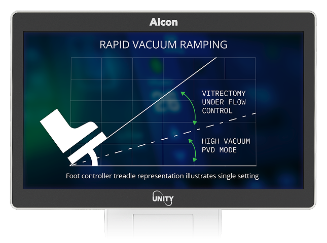 Monitor showing graph labeled “Rapid Vacuum Ramping” with foot controller icon, comparing vitrectomy under flow control and high vacuum PVD mode.