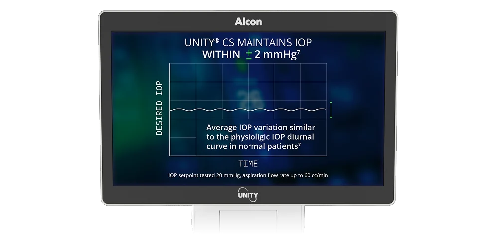 Moniteur affichant un graphique avec le texte « Le système UNITY VCS maintient la PIO à ±2 mmHg », illustrant une pression intraoculaire stable dans le temps.