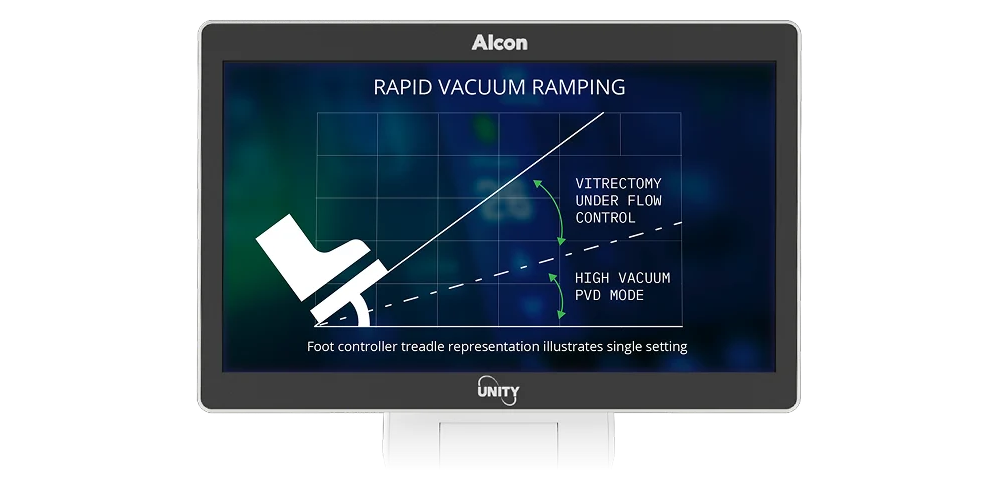 Moniteur affichant un graphique intitulé « Montée rapide du vacuum » avec l'icône de la pédale de commande, comparant la vitrectomie en mode contrôle du débit et en mode PVD sous vacuum élevé.