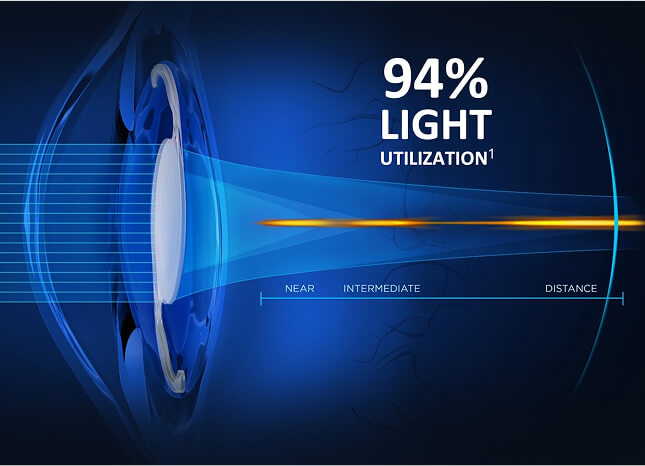 An illustration of an intraocular lens inside an eye, showing how light passes through it with 94% light utilization, improving vision from near to distance