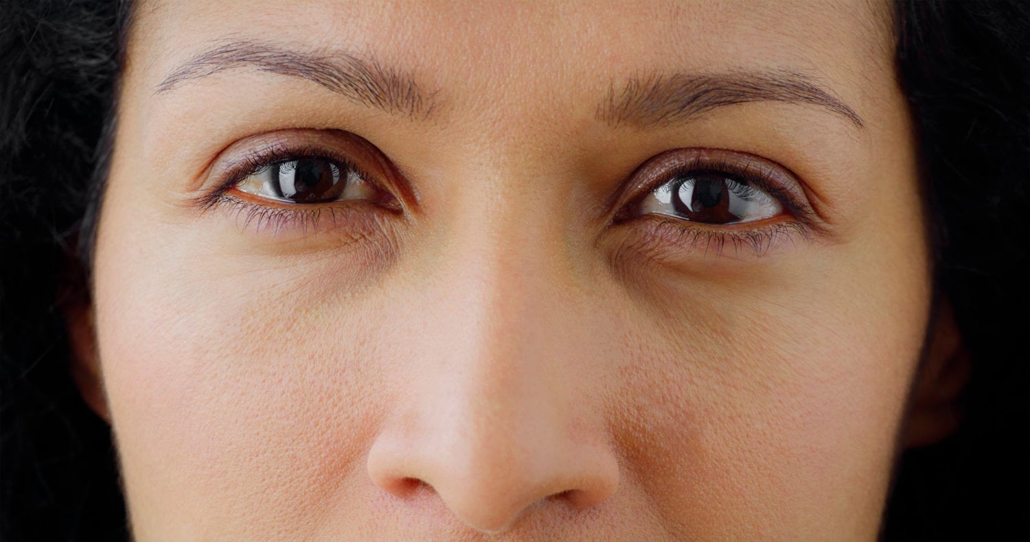 close-up of a woman with dry eye