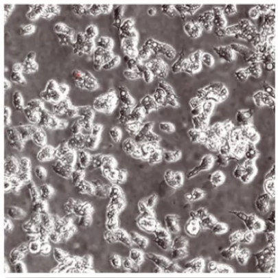 microscope slide of live acanthamoeba trophozoites