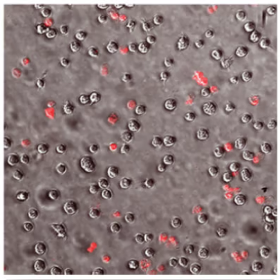 microscope slide showing low levels of red stains on Acanthamoeba trophozoites (ReNu Advanced Formula)